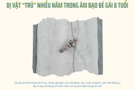 Hy hữu: Dị vật “trú” nhiều năm trong âm đạo bé gái 8 tuổi