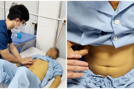 Ăn nấm tự nhiên, nhiều người ngộ độc, suy gan thận nặng