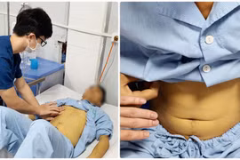 Ăn nấm tự nhiên, nhiều người ngộ độc, suy gan thận nặng