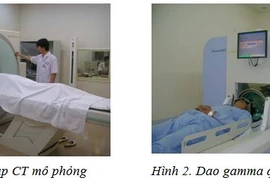 Xạ phẫu bằng dao gamma quay: Giải pháp đột phá trong điều trị u não