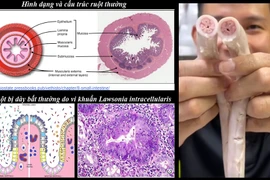 “Tác nhân” tạo lòng se điếu ở heo là do bị bệnh?
