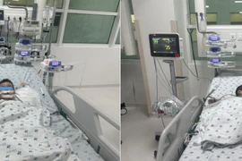 Trẻ 1 tuổi ngã từ giường xuống nền nhà vỡ khí quản