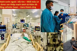 Kỹ thuật hiện đại cứu du khách nước ngoài nhồi máu cơ tim cấp