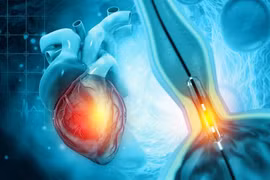 Chụp mạch vành qua đường ống thông có gây nguy hiểm?