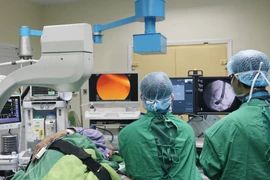 Nội soi mật tụy ngược dòng: lấy sỏi ống mật chủ mà không cần phẫu thuật