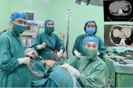 Cứu sản phụ chửa trứng biến chứng ung thư nguyên bào nuôi, di căn phổi