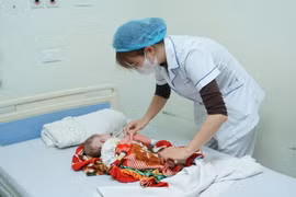 Phẫu thuật thành công cho trẻ 3 ngày tuổi bị thoát vị tủy – màng tủy