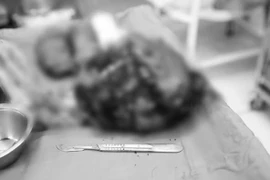 Đón bé chào đời an toàn đồng thời được loại bỏ u xơ tử cung lớn