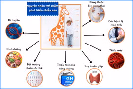 Bác sĩ mách cách nâng cao tầm vóc cho trẻ thấp còi