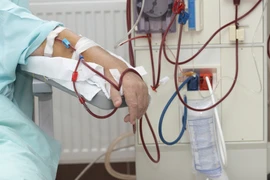 Lọc máu có hết được mỡ máu, phòng tiểu đường, đột quỵ...?