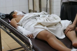Nổ bình ga trong giờ thực hành, 5 HS tiểu học bị bỏng