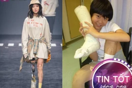 Sống sót thần kỳ sau trận động đất, cô gái hot rần rần với chiếc “chân thép ngầu đét”