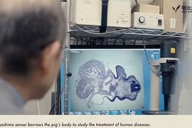 Kinh ngạc: Nhật Bản sẽ cấy ghép nội tạng heo cho người