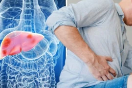 4 dấu hiệu bất thường vào buổi sáng cho thấy xơ gan, K gan đến rất gần