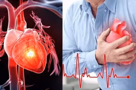 Trời lạnh, cơ thể có dấu hiệu này cần đi khám tim mạch sớm 