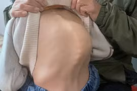 Cháu bé mắc bệnh hiểm nghèo, mồ côi cha mẹ cần giúp đỡ 