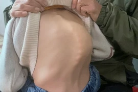 Cháu bé mắc bệnh hiểm nghèo, mồ côi cha mẹ cần giúp đỡ 