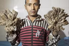 20 bức ảnh khiến chúng ta “há hốc” khi xem 