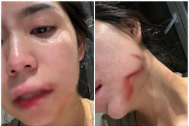 Đã có kết quả kiểm tra loạt thương tích của Hằng Du Mục