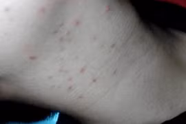 'Chấm đỏ nhỏ' mọc ở bộ phận này, cố gắng đi kiểm tra sức khỏe 