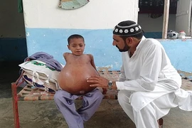 Xót xa cậu bé 9 tuổi bụng to gấp 3 lần quả bóng