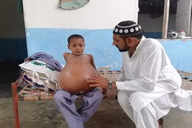 Xót xa cậu bé 9 tuổi bụng to gấp 3 lần quả bóng