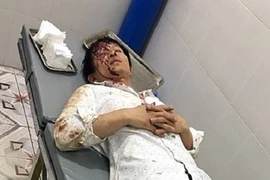 Đi đòi tiền, chủ nợ bị đánh trọng thương