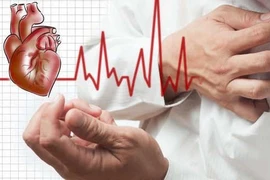 Cấp cứu bệnh nhân ngừng tuần hoàn