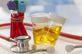 Xử lý khi có máu trong nước tiểu