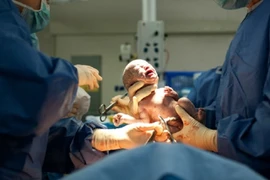 Thích sinh mổ cho an toàn... nào ngờ