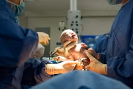 Thích sinh mổ cho an toàn... nào ngờ