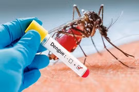 Bộ chẩn đoán Cygnus xét nghiệm nhanh sốt xuất huyết