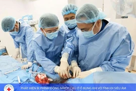 Đi siêu âm vô tình phát hiện phình động mạch chủ