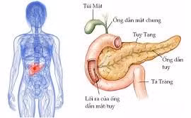 Sinh thiết trong khi mổ