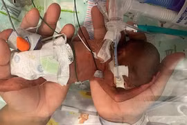 Chào đời chỉ 21 tuần tuổi, cậu bé phá kỷ lục sinh non nhất thế giới