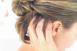 Trị nấm da đầu từ thảo dược