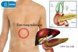 Đau bụng do viêm tụy cấp