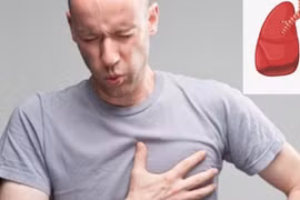 Xử lý đau ngực khi đi bộ sau mổ tim