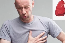 Xử lý đau ngực khi đi bộ sau mổ tim