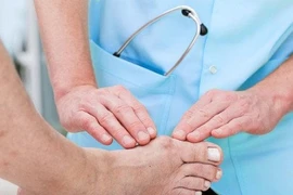 Những dấu hiệu nhận biết bệnh gút ở khớp ngón chân cái