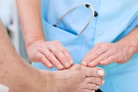 Những dấu hiệu nhận biết bệnh gút ở khớp ngón chân cái