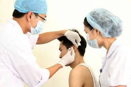 Cấy chỉ huyệt vị chữa nhiều bệnh lý