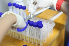 Bộ Y tế công bố ca Covid-19 tử vong thứ 38, là bệnh nhân ung thư gan