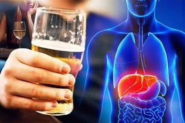 Rượu bia ảnh hưởng mọi cơ quan trong cơ thể
