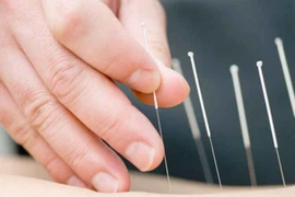 Thủy châm không dùng tại nhà