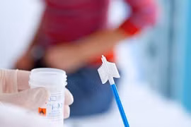 Các nguyên nhân gây dịch âm đạo bệnh lý 