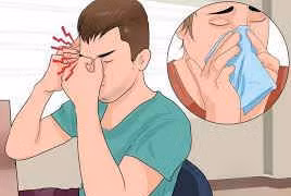 Có nên dùng chlorpheniramin trị viêm mũi dị ứng quanh năm?