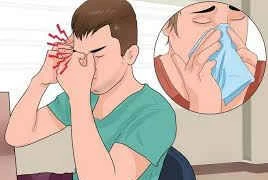 Có nên dùng chlorpheniramin trị viêm mũi dị ứng quanh năm?