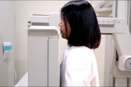 Việt Nam thuộc top dưới sàng lọc phát hiện sớm ung thư vú 