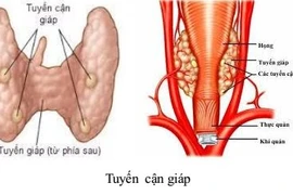 Suy tuyến cận giáp